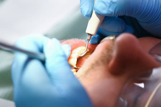 Best Walk-In Emergency Dentist in Crownpoint, NM