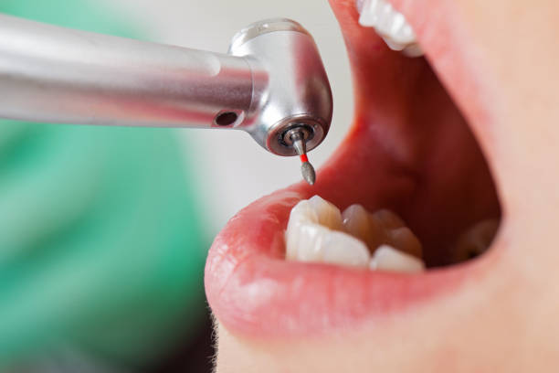 Best Emergency Broken Tooth Repair in Crownpoint, NM